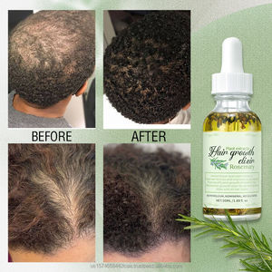 Huile de croissance capillaire liquide best-seller transfrontalier à l'aloe vera, au romarin et à la vanille, soin du visage et du cuir chevelu, huile essentielle éclaircissante et hydratante - Product Image 4