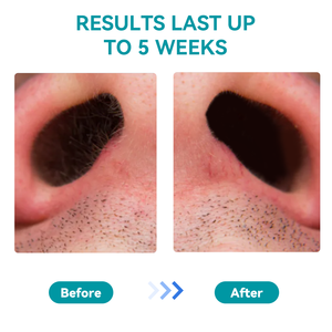 Applicateur Nasal Jetable à Pointe en Cire pour Sourcils, Prêt à l'Emploi, <span class=keywords><strong>Prix</strong></span> de Gros, pour l'<span class=keywords><strong>Épilation</strong></span> des Oreilles et du Nez - Product Image 6