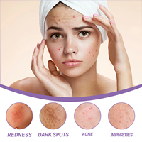 Perilla Ice Crystal Moisturizing Gel Memperbaiki dan Memudarkan Bekas Jerawat, Gel Pembersih dan Pelembap