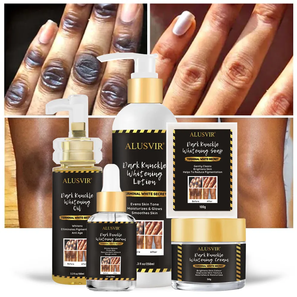 Wholesale Manufacturers Dark Knuckle Knees Remover Whitening Bleaching Serum Cream Body Lotion Oil Skin Care Set For Dark Skin