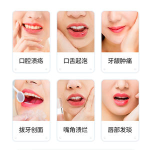 Gel pour ulcères buccaux Sunflower 20g pour les plaies buccales, les ampoules, l'extraction dentaire, la cicatrisation des plaies, les soins dentaires - Product Image 1