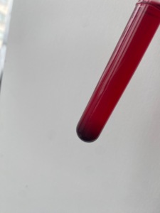 Rojo Ácido de Alta Pureza 1 para Lana, <span class=keywords><strong>Seda</strong></span> y Cosméticos - Product Image 5