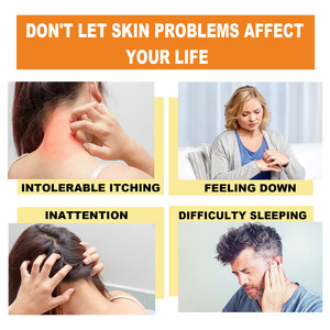 Оптовая продажа, 20 г, крем для лечения псориаза кожи - Product Image 4