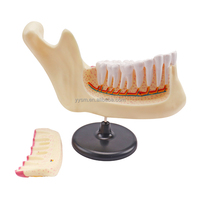 Dent humaine avec brosse enseignement médical 2 pièces meulage des dents et des engrenages modèle anatomique équipement éducatif modèle médical