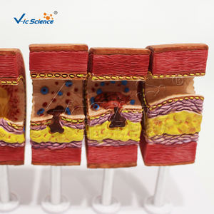 Modelo de tarjeta anatómica para enseñanza médica, modelo de Ciencia de arteriosclerosis y vasos sanguíneos - Product Image 2