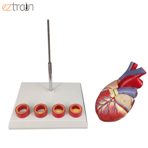Modelo de Aterosclerosis Cardíaca de 4 Etapas, Enfermedad de las Arterias Coronarias, Material de PVC+ABS, 2 Partes Desmontables para Fines Científicos - Product Image 4