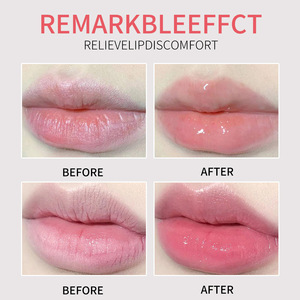 Baume à lèvres exclusif transfrontalier ADMD aux extraits de fruits pour femmes, hydratant, nourrissant, anti-gerçures, 7g, lot de 24 - Product Image 4