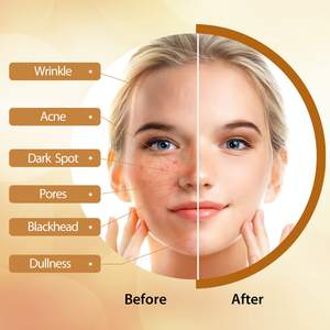 Jabón Vegano Natural en Barra de Cúrcuma y Limón Hecho a Mano, Antiacné y Blanqueador para Todo Tipo de Piel - Product Image 5