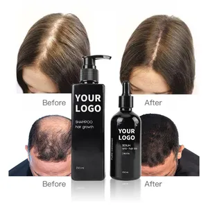 OEM шампунь для волос, объемный биотин шампунь для роста волос без сульфата шампунь для натуральных волос