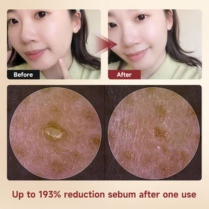 Sérum Visage Hydratant Intensif à l'Acide Hyaluronique et au Riz, Anti-Âge, Peptides, Effet Blanchissant, <span class=keywords><strong>30ml</strong></span>, Soin Bio pour <span class=keywords><strong>la</strong></span> Peau - Product Image 2