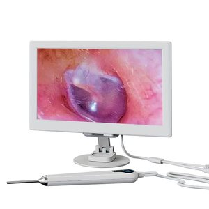 Otoscopio con Cámara HD de 10 Pulgadas <span class=keywords><strong>y</strong></span> 3.9 mm, Cámara HD Profesional para el Canal Auditivo, Endoscopio Nasal <span class=keywords><strong>y</strong></span> Oral para Examen de Oído, <span class=keywords><strong>Nariz</strong></span> <span class=keywords><strong>y</strong></span> <span class=keywords><strong>Garganta</strong></span> - Product Image 1