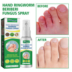 Spray de soins des <span class=keywords><strong>pieds</strong></span> Offres Spéciales apaisant démangeaisons <span class=keywords><strong>antifongique</strong></span> améliorer la sueur des <span class=keywords><strong>pieds</strong></span> malodorants - Product Image 6
