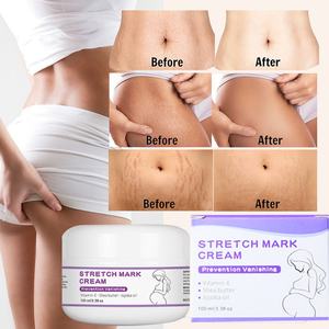 Autocollants personnalisés, crème anti-vergetures, soins de grossesse, produits pour femmes enceintes, produits de santé - Product Image 5