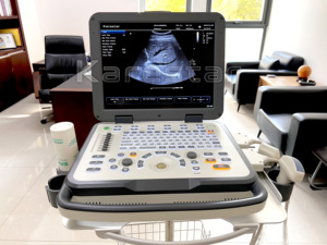 Meilleur prix - Échographe Doppler couleur portable de 15 pouces - Échographe professionnel - Échographe vétérinaire - Product Image 5