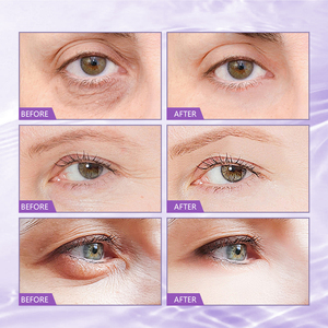 Maschere per Occhi al Collagene di Semi d'Uva e Antiossidanti, Idratanti e Illuminanti, Migliorano le Rughe Sottili e Rassodano la Pelle - Product Image 2