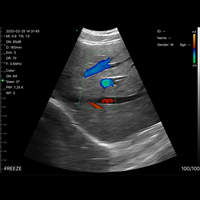 Sonda de Ultrasonido Inalámbrica 3 en 1 JM-5CPL, Escáner Portátil Doppler a Color, Sonda Convexa, Lineal y de Fase, para Uso Médico y Veterinario