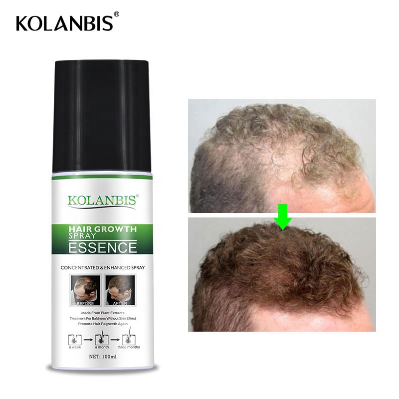 Private Label Hair Oil Growth Hair Serum Men Care Tonic Factory Price