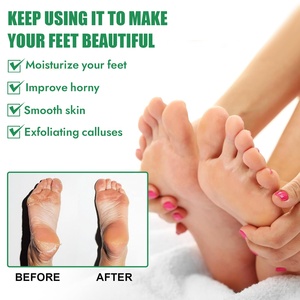 Chân Callus loại bỏ phun chăm sóc bàn chân làm mềm dưỡng ẩm nuôi dưỡng loại bỏ da chết tẩy tế bào chết lột sương - Product Image 3