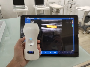 DM Medical - Sonda de Ultrasonido Inalámbrica Portátil con Wifi, 192 Elementos, 3 en 1, Doppler a Color - Product Image 2