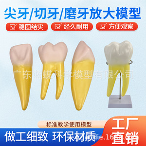 Modelo de diente humano ampliado 12 veces con molde desmontable para la anatomía del diente, pulpa, nervio, incisivos, caninos y molares. - Product Image 4