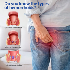 Ungüento Huainanhall <span class=keywords><strong>para</strong></span> <span class=keywords><strong>Hemorroides</strong></span>, Alivia Rápidamente y Naturalmente la Picazón, el Ardor y las Molestias de las <span class=keywords><strong>Hemorroides</strong></span>. - Product Image 5