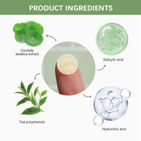 Patch Microneedle personnalisé hydrocolloïde étanche Microdart Anti-acné élimination des boutons peau visage patchs dissolvant de points noirs acné
