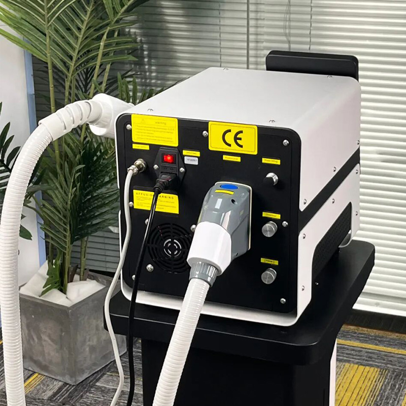 laser machine tattoo