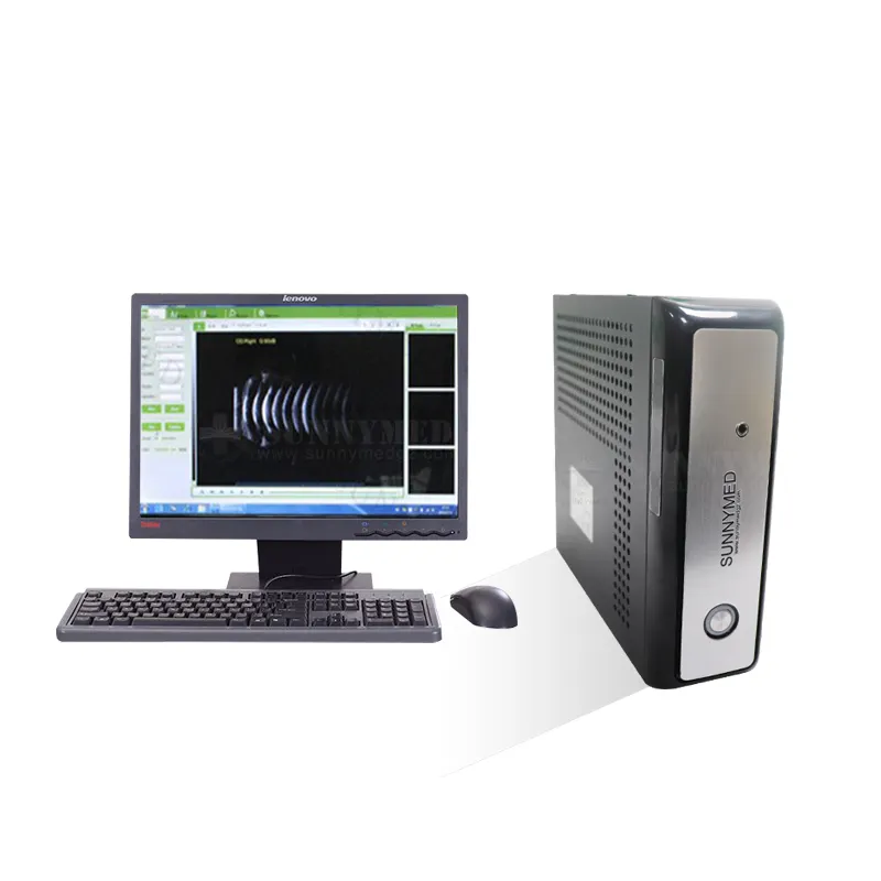 Escáner médico portátil para uso en el hogar, máquina de ultrasonido con sonda A/B, modelo SY-A041-1