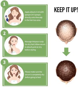 Produits OEM pour la croissance des cheveux, sérum à l'essence de gingembre pour une repousse rapide, huile pour la croissance de la barbe, soin contre la perte de cheveux, traitement du cuir chevelu pour hommes et femmes - Product Image 5