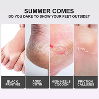 Masque exfoliant pour les pieds, logo privé OEM, exfolie la peau rugueuse, prévient la sécheresse