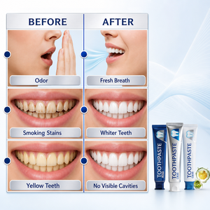 <span class=keywords><strong>Dentifrice</strong></span> blanchissant pour adultes avec charbon, niacinamide et <span class=keywords><strong>miswak</strong></span> pour dents sensibles, soin anti-caries et nettoyage buccal - Product Image 5