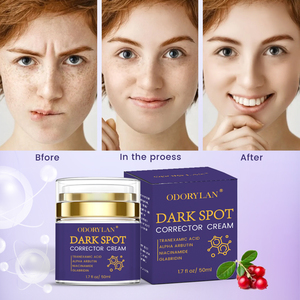 Crema Notte Magica Rimuovi Macchie Sri Rose Himalaya Gold 100g dalla Malesia e dalla Thailandia - Product Image 6