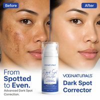 Gel Éclaircissant à la Niacinamide et à la Caféine Marque Blanche, Soin Visage Anti-Taches et Imperfections, Essence Faciale