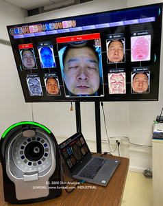 Dispositivo <span class=keywords><strong>de</strong></span> análisis cutáneo para cadenas minoristas - Product Image 4