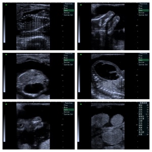 Máquina de Ultrasonido Veterinaria Portátil de Bajo <span class=keywords><strong>Precio</strong></span> para Ganado, Caballos, Cerdos, Ovejas y Camellos, Control <span class=keywords><strong>Prenatal</strong></span> - Product Image 4