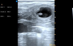 Besscan S5 Plus vétérinaire scanner à ultrasons, scanner à ultrasons de haute qualité d'imagerie vache scanner à ultrasons vétérinaire portable 2022 - Product Image 4