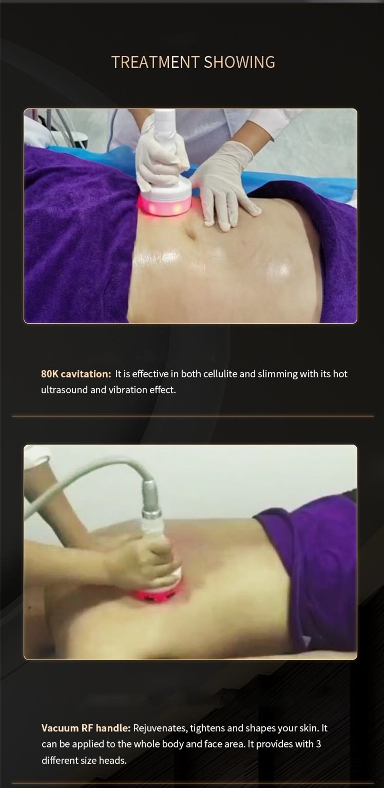 6 IN 1 lipolaser 650nm lipolaser vacuum cavitation rf/multifunction rf lipo laser beauty machine 7 in 1