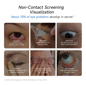 MEIBOYI Digitales Irisanalyse-System Augen-Iriskop Iridologie Iris-/Haar-/Hautanalysegerät Iriskop Iridologie-Kamera Iris-Analysator 2025 - Product Image 6