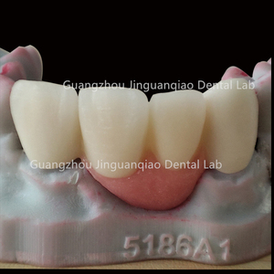 Couronnes et ponts dentaires <span class=keywords><strong>en</strong></span> <span class=keywords><strong>zircone</strong></span> <span class=keywords><strong>en</strong></span> couches de porcelaine avec gomme <span class=keywords><strong>en</strong></span> porcelaine pour dents antérieures - Product Image 6