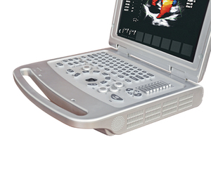 Sondas Convexas y Lineales, Escáner de Ultrasonido Doppler a Color para Laptop, Ultrasonido Veterinario, Máquina de Ultrasonido Portátil - Product Image 3