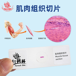 El tejido muscular, las células musculares lisas (secciones longitudinales y transversales), son los componentes del movimiento del cuerpo humano. - Product Image 3