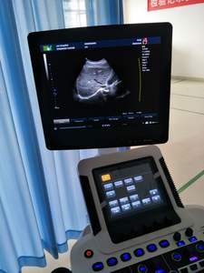Zonecare <span class=keywords><strong>Ultrasound</strong></span> Perut Doppler Warna Lanjutan dengan Gambar Elastisitas - Product Image 2