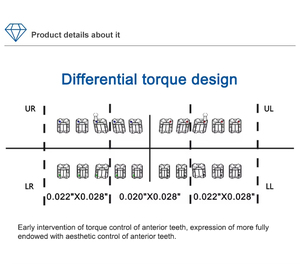 Aparatos de <span class=keywords><strong>Ortodoncia</strong></span> Dentales Shinye - Alineadores Transparentes Invisibles, Enderezamiento Dental Manual, Removibles y Cómodos - Product Image 3
