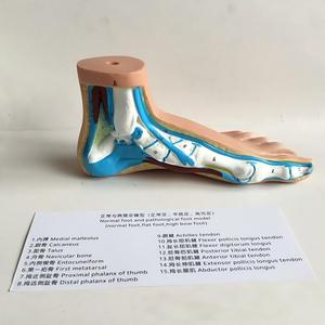 Podiatri Öğretimi için 3 Çeşit Ayak Kemeri Anatomisi Modeli Normal Düz ve Yüksek Kemerli Ayaklar - Product Image 3