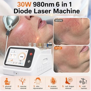 Máquina de Depilación Láser de Diodo 6 en 1 de 30W 980nm, Rejuvenecimiento de la Piel, Equipo de Fisioterapia para Eczema y Hongos en las Uñas - Product Image 2