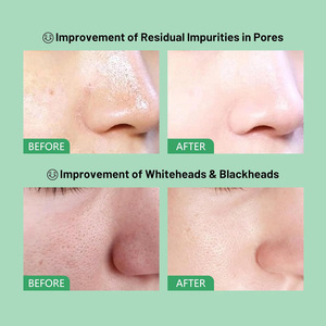 CREMA FACIAL DE ARCILLA DE TOMATE VERDE con VITAMINA C, FRAGANCIA NATURAL, HIDRATANTE, TAMAÑO REGULAR, Tratamiento Limpiador Profundo - Product Image 4