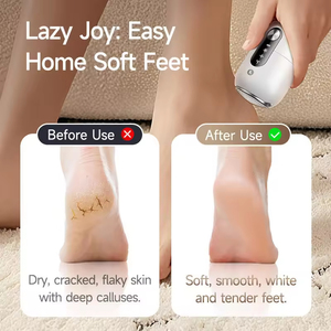 <b>Electric</b> Foot Callus Remover with <b>Diffuser</b> Gemstone & ABS Material 3 Modes (Gentle/Medium/Strong) Cleaning Personal Care Tool - Product Image 5