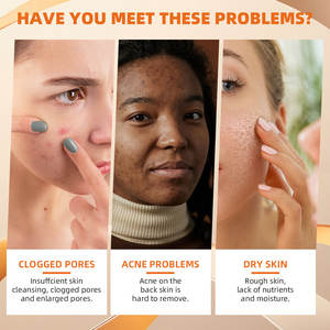 Venta al por mayor orgánico piel sensible hecho a mano blanqueamiento aligeramiento suave brillo zanahoria <span class=keywords><strong>natural</strong></span> jabón facial - Product Image 3