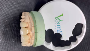 Disque CadCam dentaire multicouche en zircone 46% translucidité SHT matériaux céramiques esthétiques en dentisterie - Product Image 4