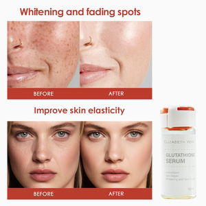 Suero Hidroglutatión Profesional para el Cuidado de la Piel, Iluminador y Revitalizante, para Mejorar la Opacidad e Hidratación Duradera - Product Image 5